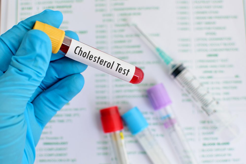 facts about cholesterol